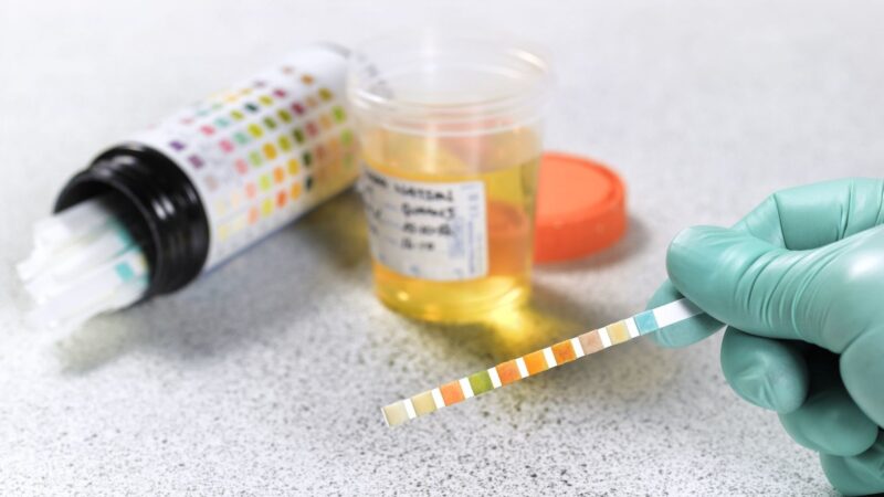 Improve your expertise about the best synthetic urine kits to buy online