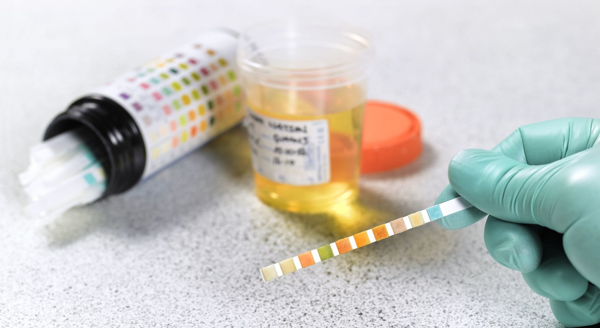 Improve your expertise about the best synthetic urine kits to buy online