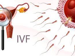 IVF Treatments: Your Eligibility for Each of the 4 Types
