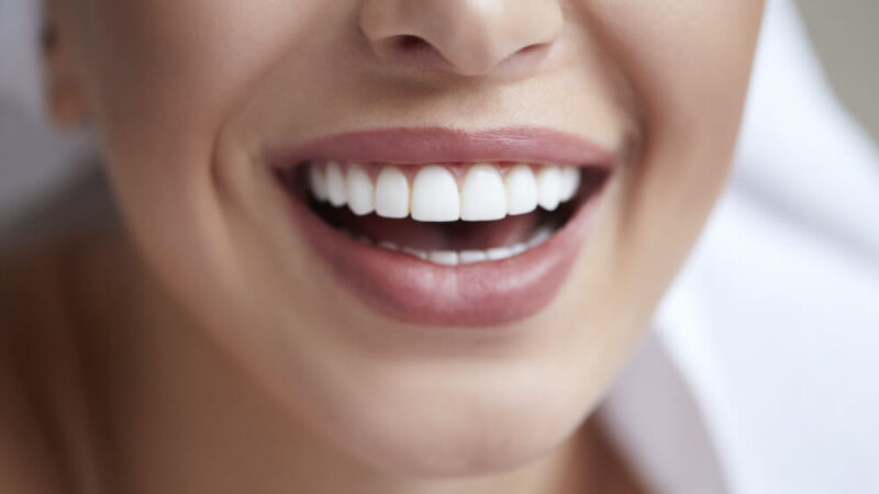 Cosmetic Dental Procedures 