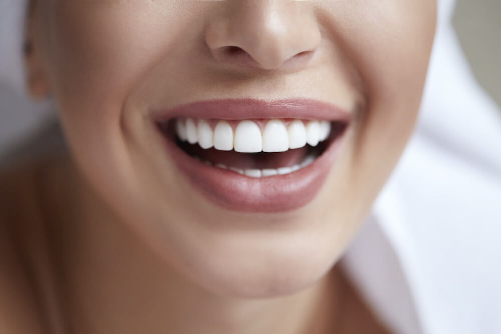 Cosmetic Dental Procedures 